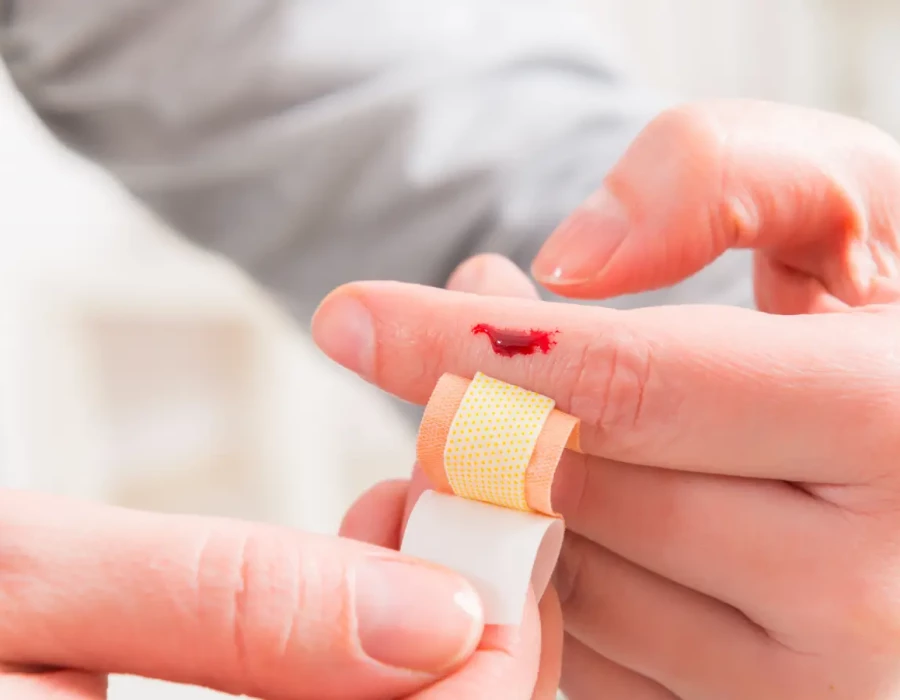 اصابات بسيطة